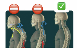 Posición del cuello: incorrecta y correcta